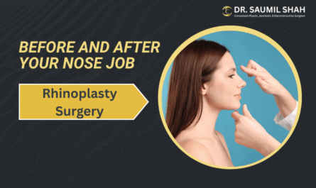 Rhinoplasty Surgery: The Days Before and After Your Nose Job