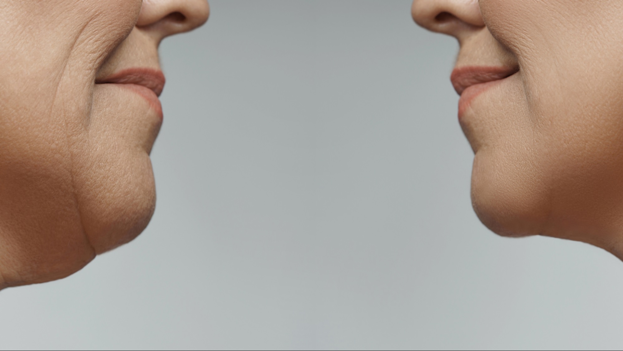 Understanding the Causes of Double Chin Fat