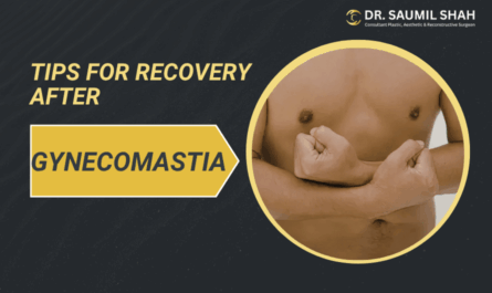 Tips for Recovery after Gynecomastia Surgery
