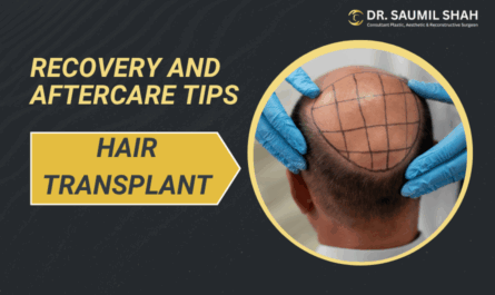 Recovery and Aftercare Tips from a Hair Transplant