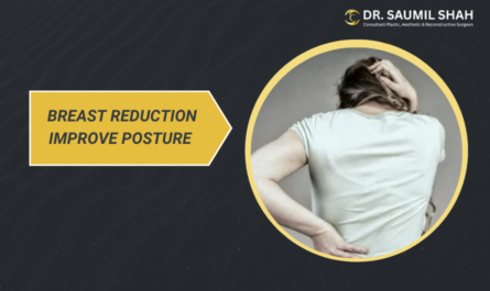 can-breast-reduction-improve-posture-and-reduce-back-pain