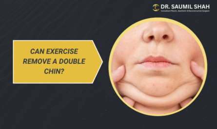 can-excercise-really-remove-a-double-chin-what-actually-works
