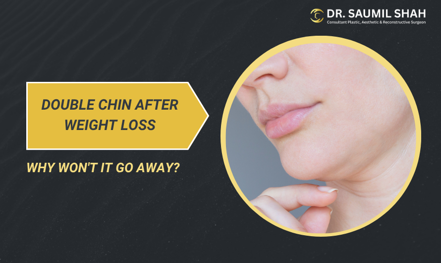 Why Won’t My Double Chin Go Away Even After Weight Loss?