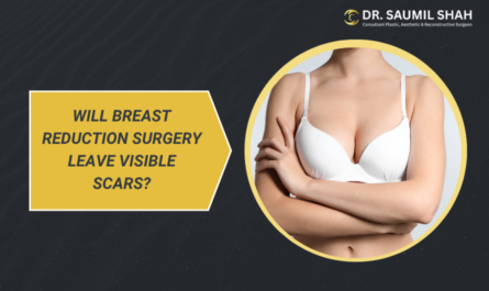 will-breast-reduction-surgery-leave-visible-scars