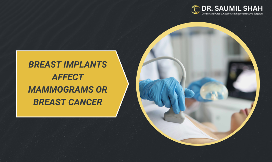 Can Breast Implants Affect Mammograms or Breast Cancer Screening?