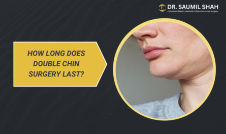 how-long-does-double-chin-surgery-last