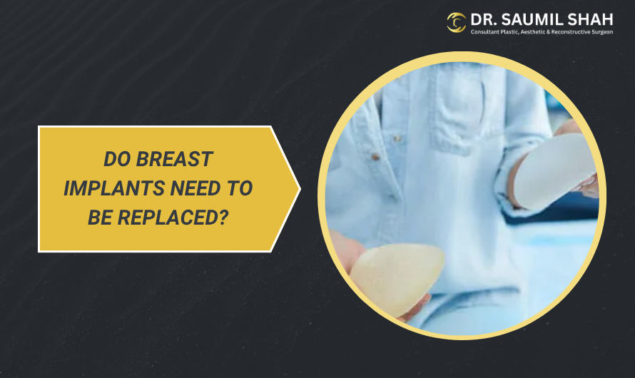 do-breast-implants-need-to-be-replaced