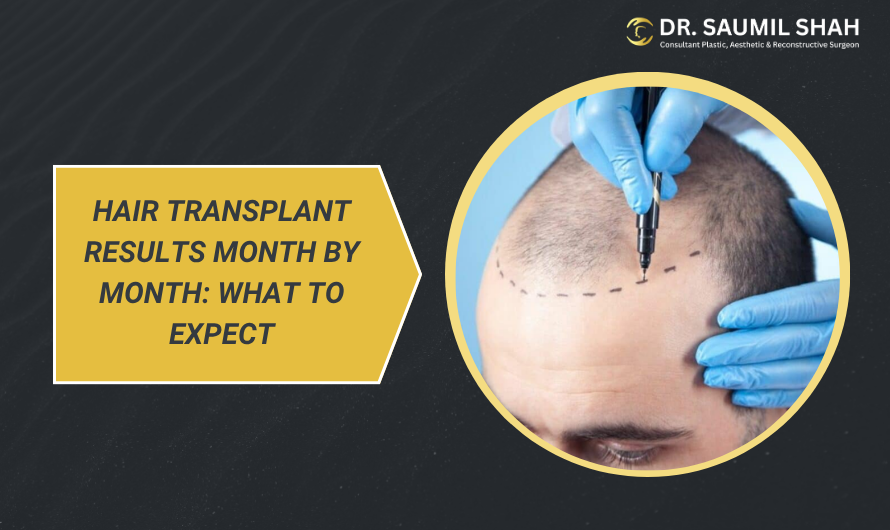 how-long-does-it-take-to-breathe-normally-after-septoplasty-1