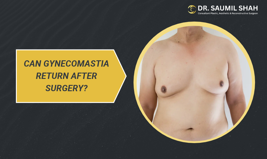 can-gynecomastia-return-after-surgery